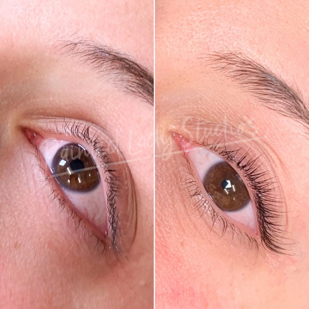 Visible eye lift results showing brighter, more lifted eyes after treatment at Painted Lady Studios in Syracuse NY.